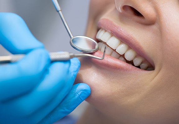Close up of dental cleaning