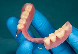 an example of partial dentures in Lewisville