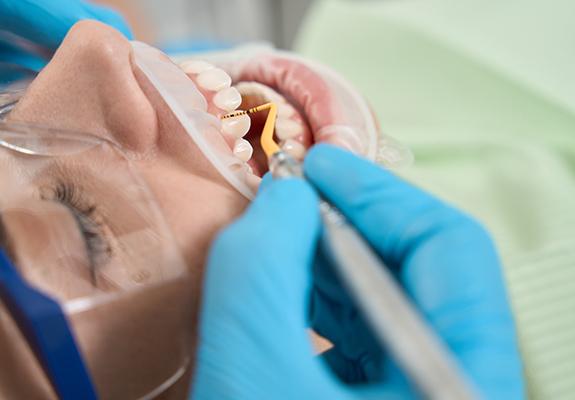 Patient in Lewisville getting gum disease treatment