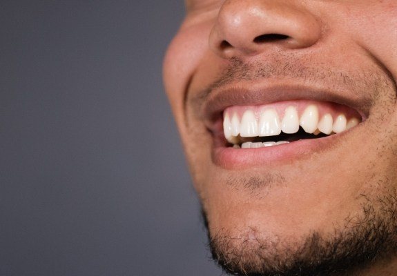 Closeup of healthy smile after gum disease treatment