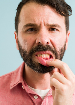 A man with gum disease