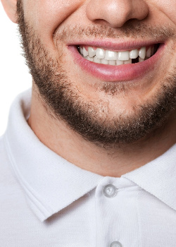 A man with a missing tooth