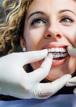 A woman wearing a clear aligner