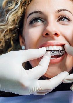 A woman wearing a clear aligner