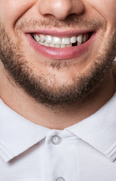 Closeup of smile with missing tooth